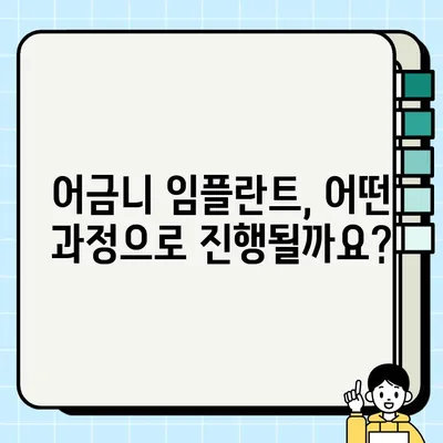 어금니 임플란트 가격, 비용, 수명, 과정, 기간, 통증 완벽 정리 | 임플란트, 치과, 치료